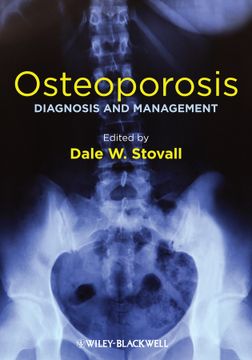 portada Osteoporosis: Diagnosis and Management (en Inglés)