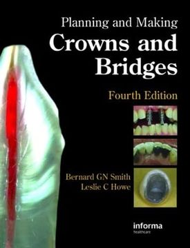 portada Planning and Making Crowns and Bridges (en Inglés)
