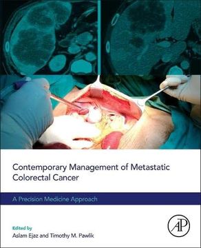 portada Contemporary Management of Metastatic Colorectal Cancer: A Precision Medicine Approach (en Inglés)