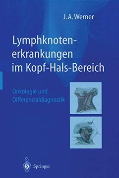 portada Lymphknotenerkrankungen im Kopf-Hals-Bereich: Onkologie und Differenzialdiagnostik (en Alemán)