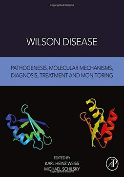 portada Wilson Disease: Pathogenesis, Molecular Mechanisms, Diagnosis, Treatment and Monitoring (en Inglés)