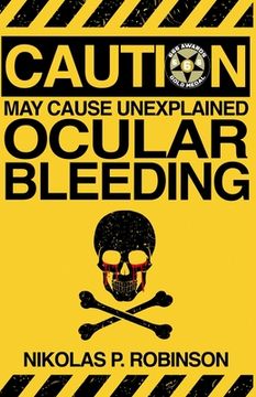 May Cause Unexplained Ocular Bleeding (en Inglés)