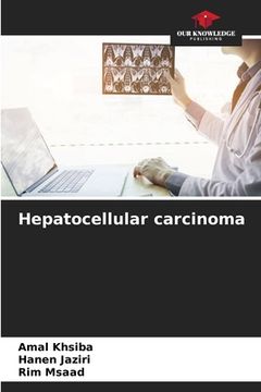 portada Hepatocellular carcinoma (en Inglés)