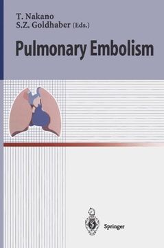 portada pulmonary embolism (en Inglés)