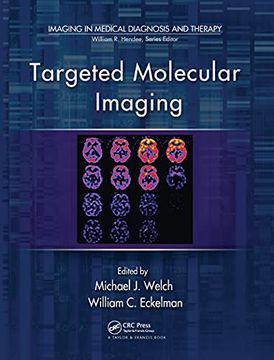 portada Targeted Molecular Imaging (Imaging in Medical Diagnosis and Therapy) (en Inglés)