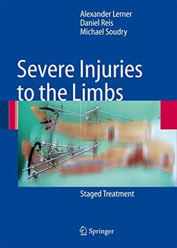 portada Severe Injuries to the Limbs: Staged Treatment (in English)