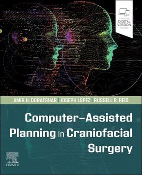 portada Computer-Assisted Planning in Craniofacial Surgery (in English)
