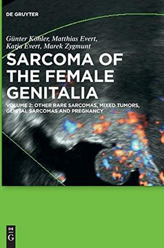 portada Other Rare Sarcomas, Mixed Tumors, Genital Sarcomas and Pregnancy: Other Rare Sarcomas, Mixed Tumors, Genital Sarcomas and Pregnancy (en Inglés)