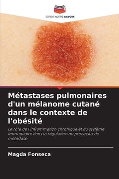 portada Métastases pulmonaires d'un mélanome cutané dans le contexte de l'obésité (en Francés)