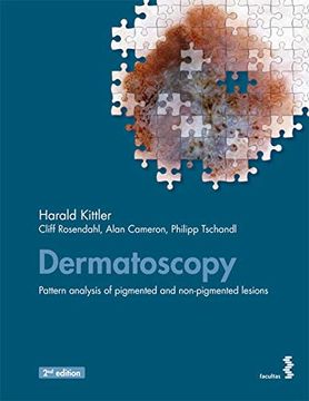 portada Dermatoscopy: An Algorithmic Method Based on Pattern Analysis (en Inglés)