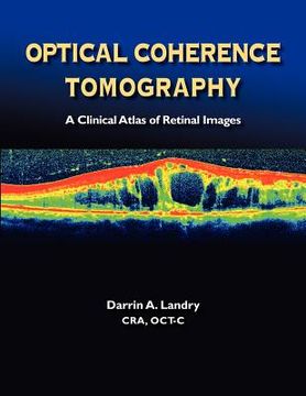 portada optical coherence tomography a clinical atlas of retinal images (in English)