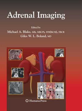 portada Adrenal Imaging (en Inglés)