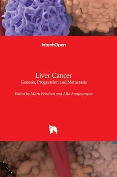 portada Liver Cancer - Genesis, Progression and Metastasis (en Inglés)