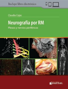 portada Neurografía por RM. Plexos y nervios periféricos