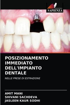 portada Posizionamento Immediato Dell'impianto Dentale (en Italiano)