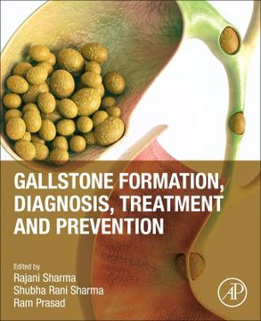 portada Gallstone Formation, Diagnosis, Treatment and Prevention (in English)