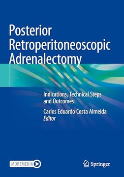 portada Posterior Retroperitoneoscopic Adrenalectomy: Indications, Technical Steps and Outcomes