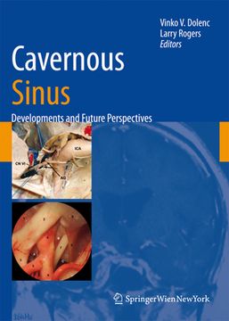 portada Cavernous Sinus: Developments and Future Perspectives (en Inglés)
