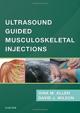 portada Ultrasound Guided Musculoskeletal Injections, 1e