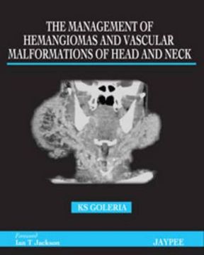portada the management of hamangiomas and vascular malformations of head and neck