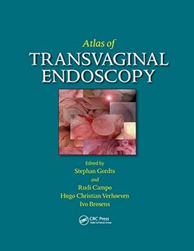 portada Atlas of Transvaginal Endoscopy (in English)