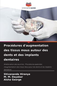 portada Procédures d'augmentation des tissus mous autour des dents et des implants dentaires (en Francés)