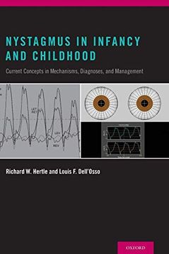 portada Nystagmus in Infancy and Childhood: Current Concepts in Mechanisms, Diagnoses, and Management (en Inglés)