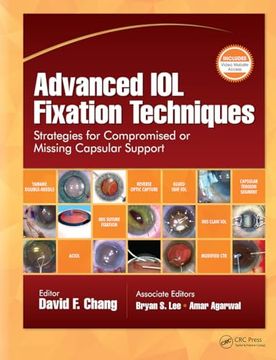 Advanced iol Fixation Techniques: Strategies for Compromised or Missing Capsular Support (en Inglés)