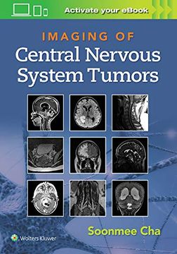 portada Imaging of Central Nervous System Tumors (en Inglés)