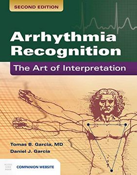 portada Arrhythmia Recognition: The Art of Interpretation: The Art of Interpretation