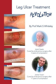portada Leg Ulcer Treatment Revolution (in English)