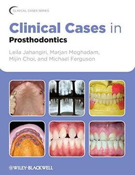 portada Clinical Cases in Prosthodontics (in English)