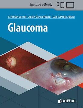 portada Glaucoma (in Spanish)