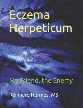 portada Eczema Herpeticum: My Friend, the Enemy (en Inglés)