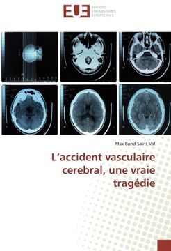 portada L’accident vasculaire cerebral, une vraie tragédie (Omn.Univ.Europ.) (French Edition)