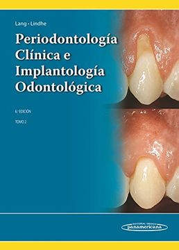portada Periodontología Clínica e Implantología Odontológica