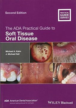 portada The ADA Practical Guide to Soft Tissue Oral Disease (en Inglés)