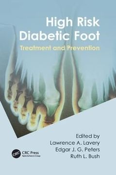 portada High Risk Diabetic Foot: Treatment and Prevention (en Inglés)