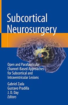 portada Subcortical Neurosurgery: Open and Parafascicular Channel-Based Approaches for Subcortical and Intraventricular Lesions (in English)