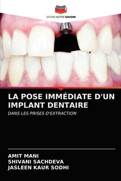 portada La Pose Immédiate d'Un Implant Dentaire (en Francés)