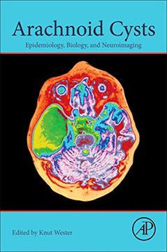 portada Arachnoid Cysts: Epidemiology, Biology, and Neuroimaging