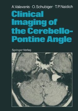 portada clinical imaging of the cerebello-pontine angle (en Inglés)