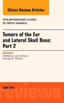 portada Tumors of the ear and Lateral Skull Base: Part 2, an Issue of Otolaryngologic Clinics of North America (Volume 48-3) (The Clinics: Internal Medicine, Volume 48-3) (en Inglés)