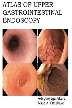 portada Atlas of Upper Gastrointestinal Endoscopy (in English)