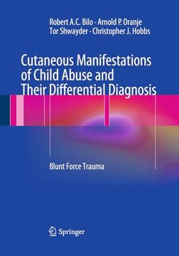 portada Cutaneous Manifestations of Child Abuse and Their Differential Diagnosis: Blunt Force Trauma (en Inglés)