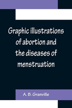 portada Graphic illustrations of abortion and the diseases of menstruation; Consisting of Twelve Plates from Drawings Engraved on Stone, and Coloured by Mr. J (en Inglés)