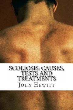portada Scoliosis: Causes, Tests and Treatments (en Inglés)