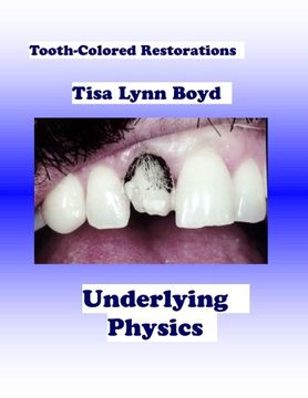 portada Tooth-Colored Restorations: Underlying Physics