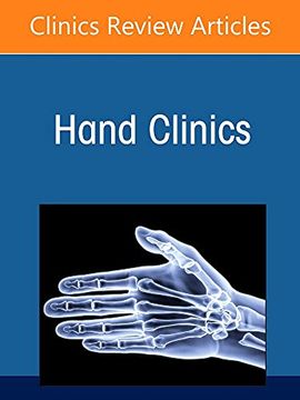 portada Current Concepts in Thumb Carpometacarpal Joint Disorders, an Issue of Hand Clinics (Volume 38-2) (The Clinics: Internal Medicine, Volume 38-2) (in English)