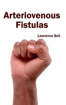 portada Arteriovenous Fistulas (in English)
